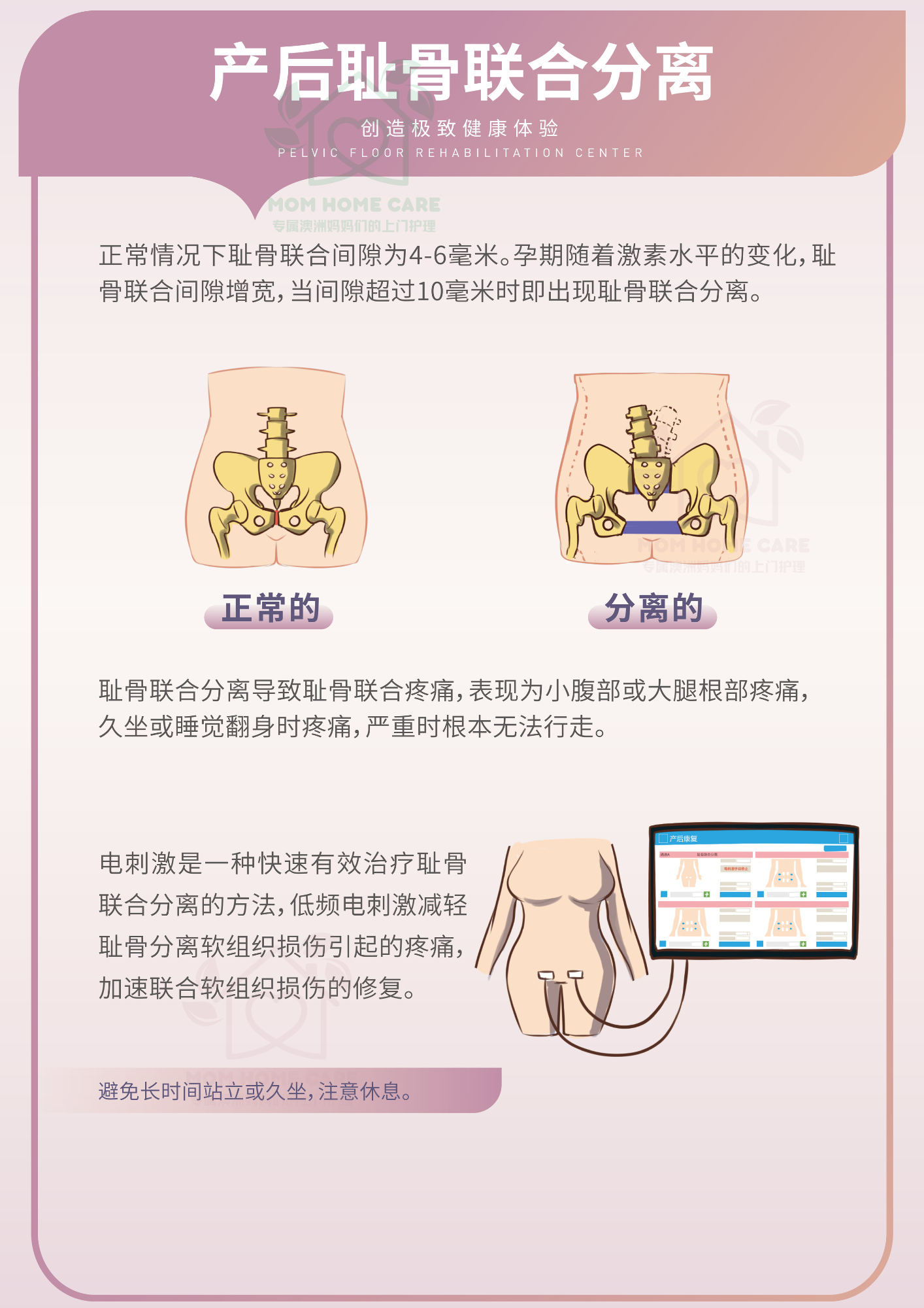 产后耻骨联合分离